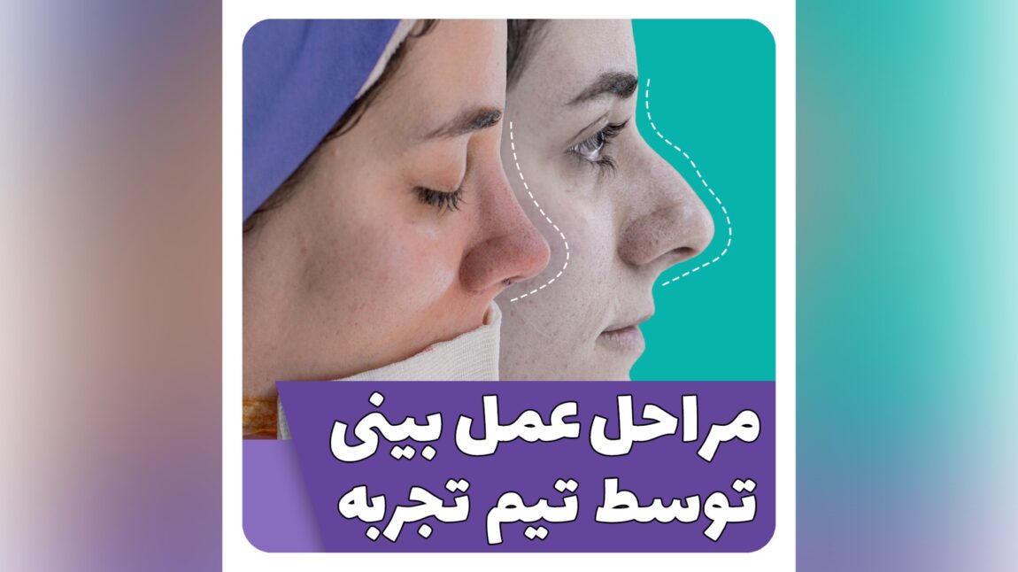 تغییرات عمل بینی سحر